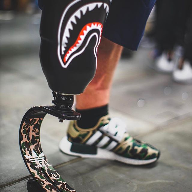 遭遇,生死,事故,Sneaker,球鞋,让,被,截肢,的,他  遭遇生死事故，Sneaker 球鞋让被截肢的他重新站起来！